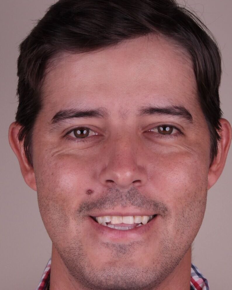 Antes — Sorriso mais claro e proporcional